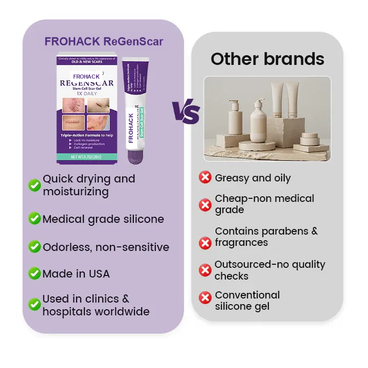 FROHACK product comparison infographic