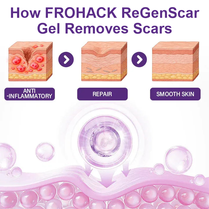 FROHACK skin care process infographic