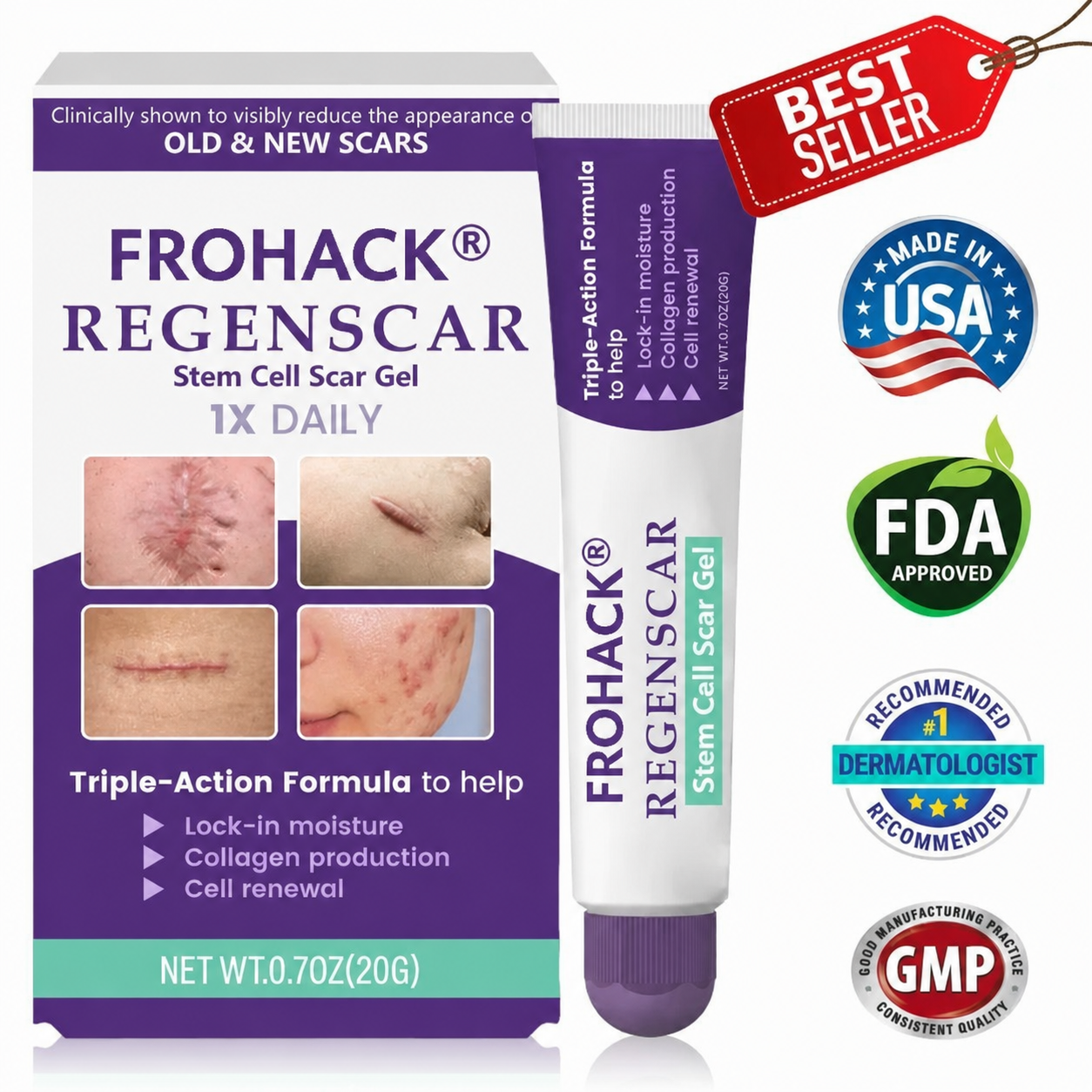 FROHACK ReGen Scar Gel box and tube