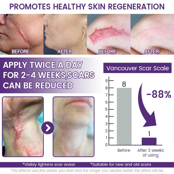 Skin regeneration and scar appearance reference infographic