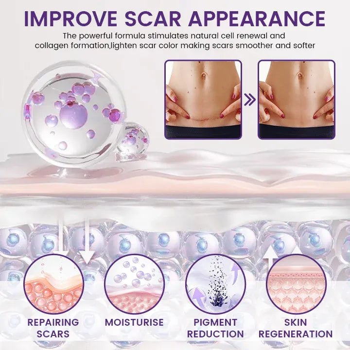 Scar appearance care infographic